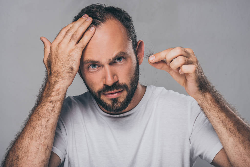 A man dealing with male hair regrowth issues