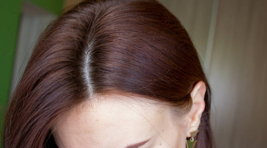 Ladies, Here’s How to Fix Your Damaged Hairline