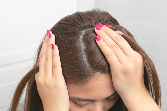 Do I have scalp psoriasis or dandruff?