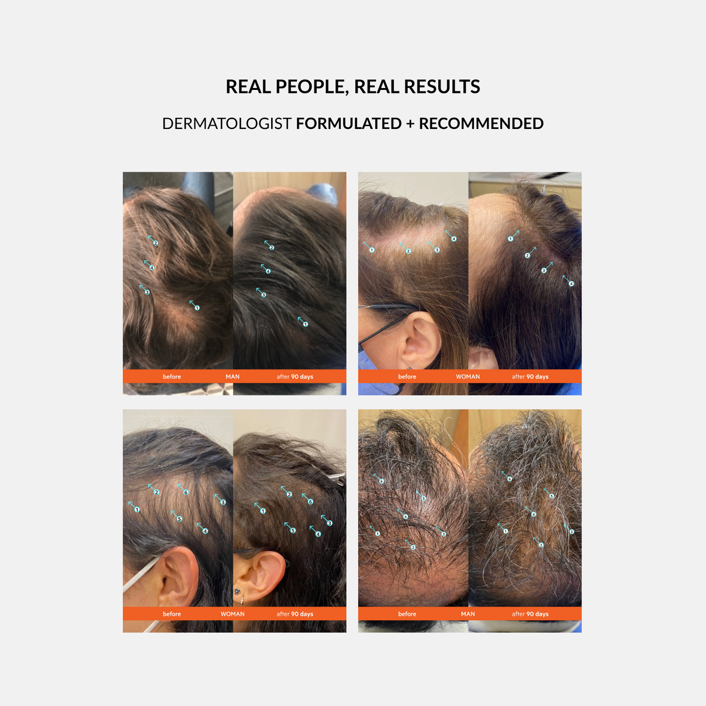 Revita Kit | High-Performance Hair Density Shampoo & Conditioner