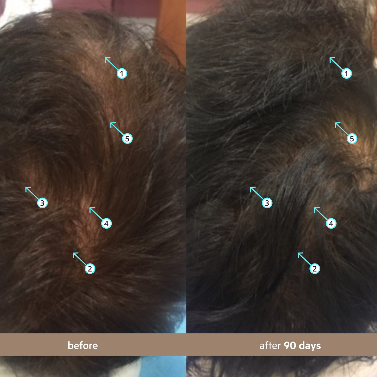 DS Laboratories Men’s Hair Density Kit