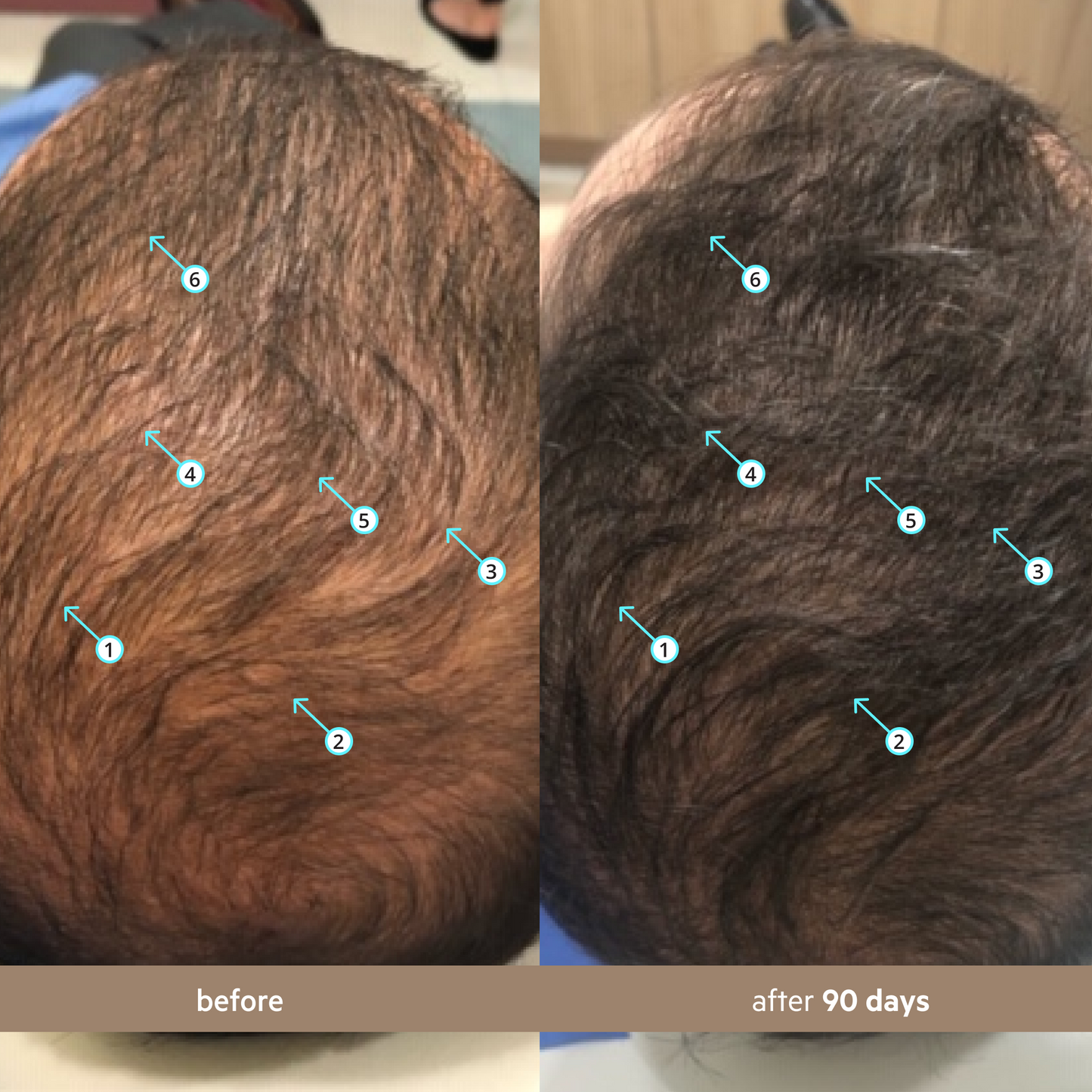 Spectral Men's (DNC-N) | Redensifying Serum w/ Nanoxidil® 5%