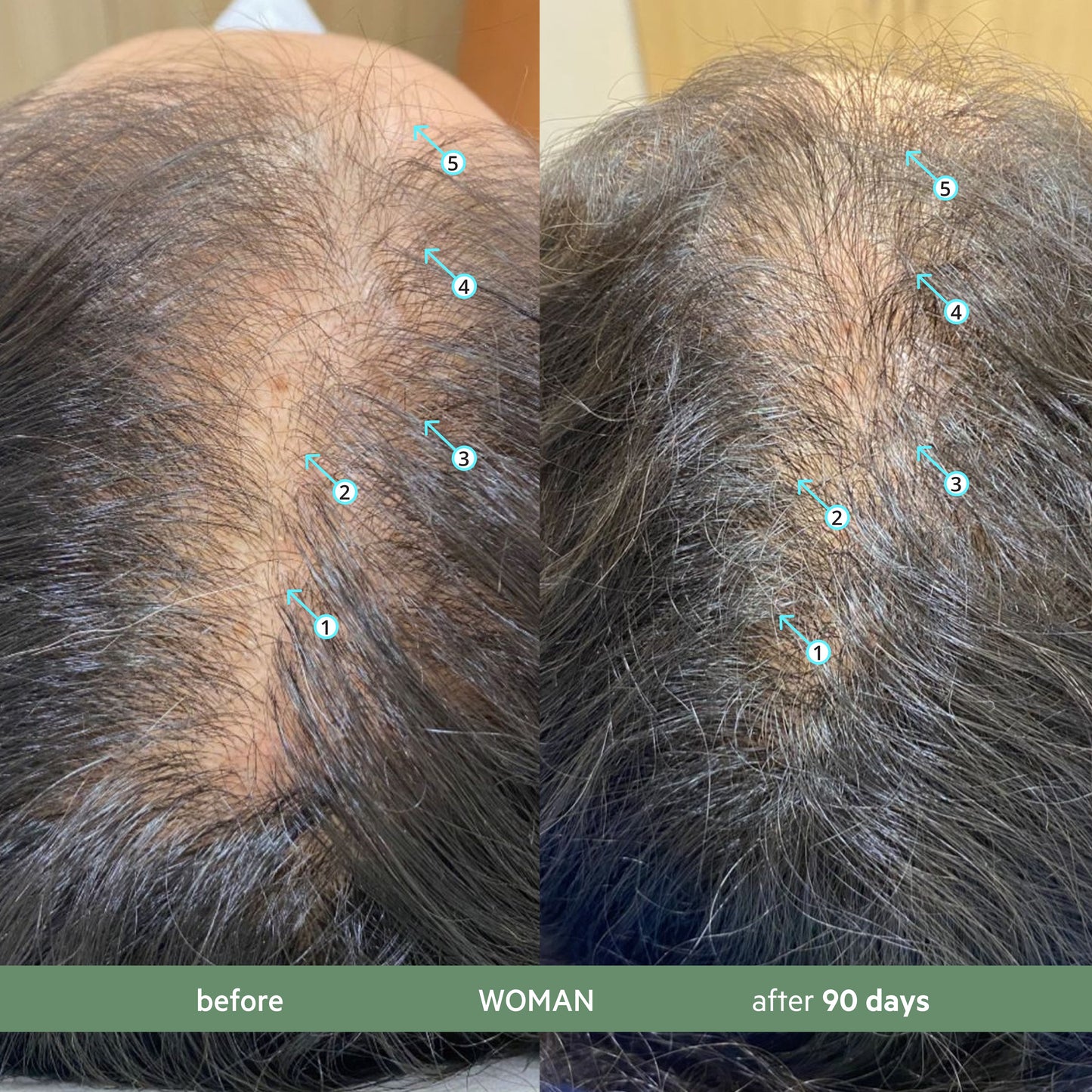 Revita.CBD | Super Antioxidant Hair DENSITY CBD Conditioner