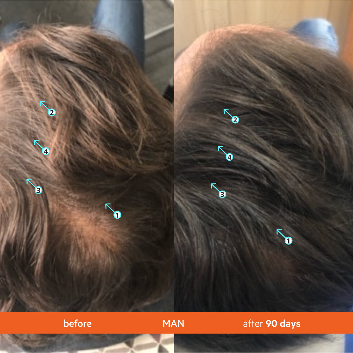 Postpartum Hairloss Bundle